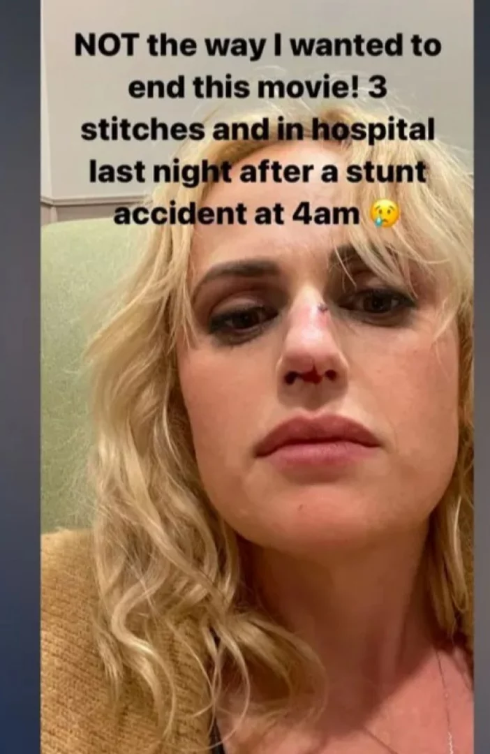 Rebel Wilson needed stitches after 'stunt accident'