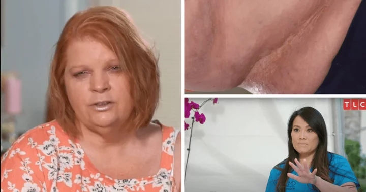 Where is Wanda now? 'Dr Pimple Popper' treats mysterious mark caving inside patient's skin following quick biopsy