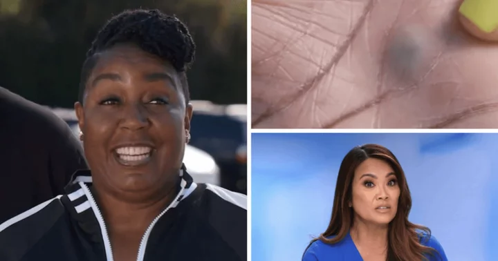 Where is Erica now? Dermatologist Sandra Lee treats 45-year-old hand bump in 'Dr Pimple Popper' Season 9