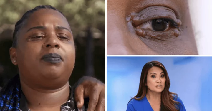 'Dr Pimple Popper': Where is Ebonee now? Dr Sandra Lee helps patient regain confidence by ditching sunglasses