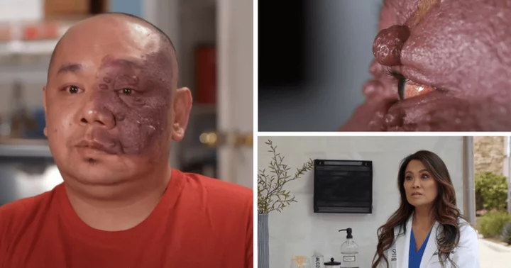'Dr Pimple Popper' Season 9: Where is Nhan now? Dr Sandra Lee and Dr Arisa Ortiz tag-team to tackle patient's port wine stain