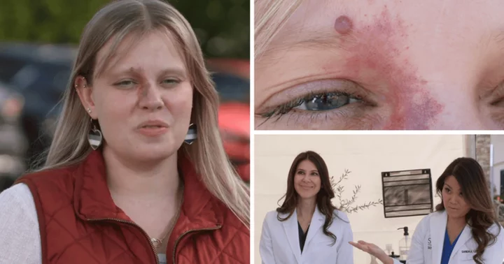 Where is Kylie now? Dr Lee and Dr Arisa Ortiz team up to treat 'Dr Pimple Popper' patient with 'constant dripping' bump