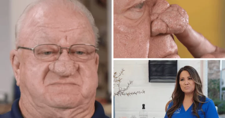 'Dr Pimple Popper': Reclusive patient John seeks Dr Lee's help to treat 'plum-sized' nose