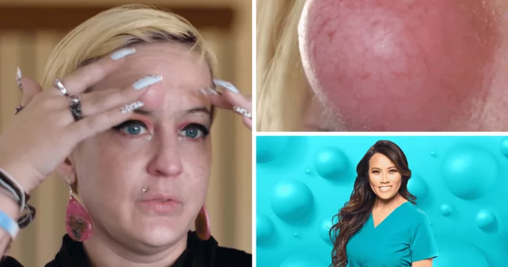 'Dr Pimple Popper' Season 9: Where is Krystal now? Dr Sandra Lee's patient's 'unicorn bump' made her self-conscious
