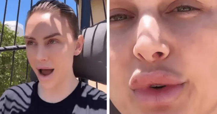 'Don't touch your own face': Lala Kent hits back at trolls mocking her plump pout with bruises