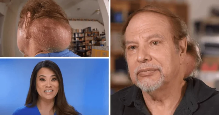 Where is Jess now? 'Dr Pimple Popper' tackles softball-sized lipoma on the neck of a 71-year-old widower trying to find love again