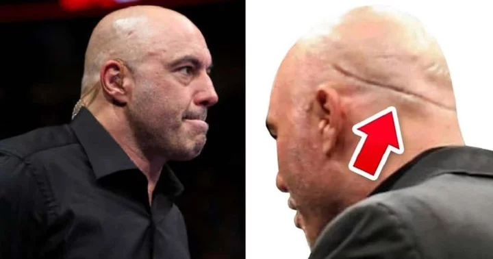What happened to Joe Rogan? Why does podcaster have 'big scar' on the back of his head 'like a smile'?