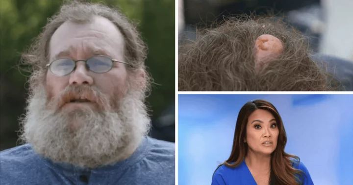 'Dr Pimple Popper' Season 9: Dr Sandra Lee meets Shad with bump on his head that looks like a pig's snout