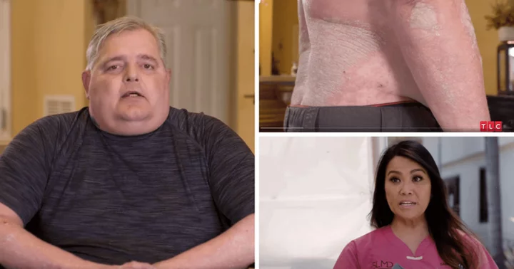 Where is Don now? 'Dr Pimple Popper' helps patient by treating his ‘burning cement’ skin condition