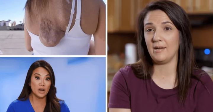 Where is Amanda now? 'Dr Pimple Popper' patient scares Dr Sandra Lee with saggy growth on her back