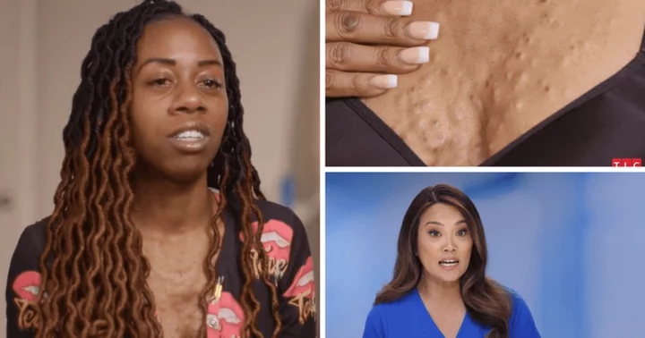 'Dr Pimple Popper': Dr Sandra Lee fights through cramps to remove Brittney's 'buttery oil-filled cysts'