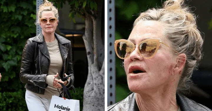 Melanie Griffith looks chic in motorcycle jacket as she’s seen with bruise marks outside LA spa