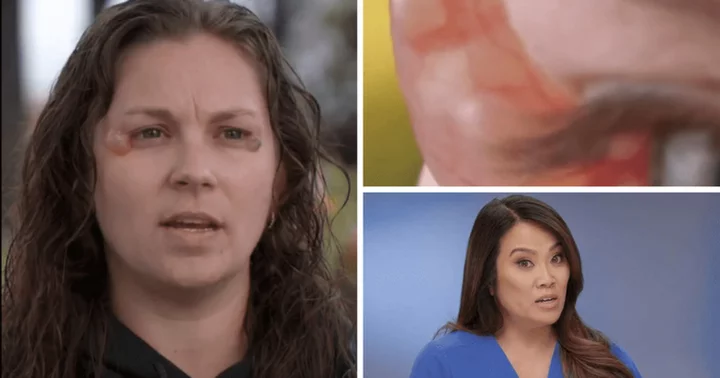 'Dr Pimple Popper' Season 9: Where is Christina now? Dr Sandra Lee helps patient regain peripheral vision by removing blistery bump like 'grapefruit'