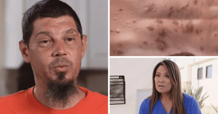 'Dr Pimple Popper' Season 9: Where is Jeb now? Dr Lee helps beach-lover by treating his oozing blackheads, pimples and cysts
